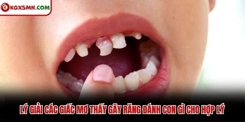 Lý giải các giấc mơ thấy gãy răng đánh con gì cho hợp lý