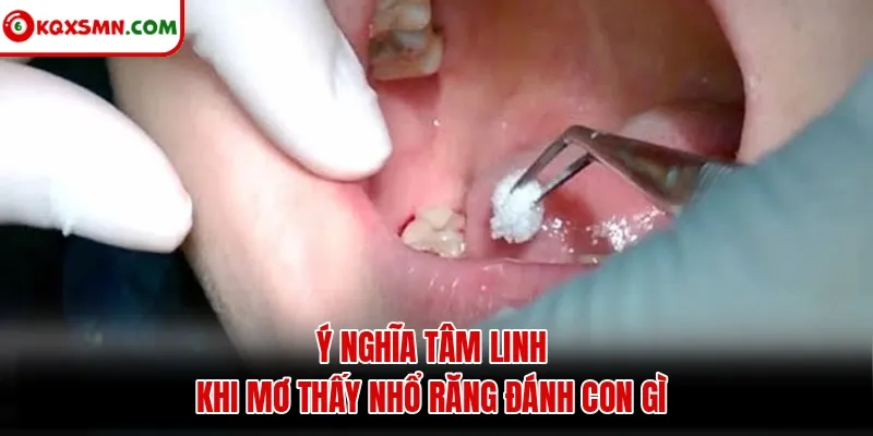 Ý nghĩa tâm linh khi mơ thấy nhổ răng đánh con gì