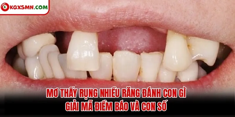 Mơ thấy Rụng nhiều răng đánh con gì? Giải mã điềm báo và con số