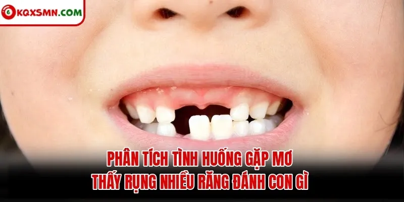 Phân tích tình huống gặp mơ thấy rụng nhiều răng đánh con gì