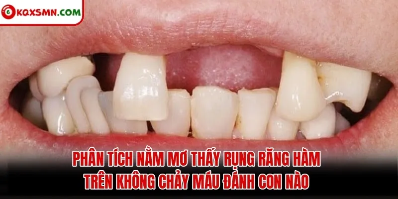 Phân tích Nằm Mơ Thấy Rụng Răng Hàm Trên Không Chảy Máu Đánh Con Nào